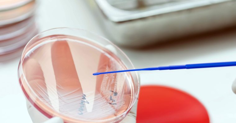 Illustration de l'article Abionyx Pharma lève 1,8 million d’euros pour poursuivre ses recherches contre le sepsis