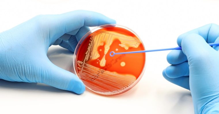 Illustration de l'article Santé : Abionyx Pharma s’apprête à lever plus de 30 millions d’euros pour développer son médicament contre le sepsis